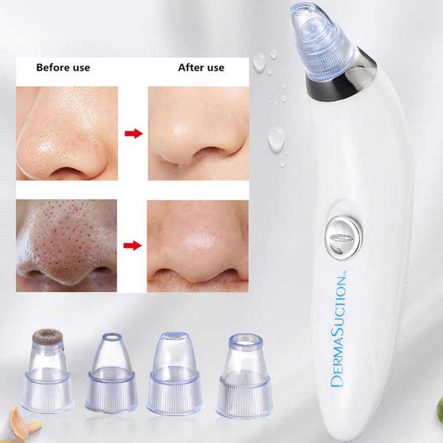 Vacuum Blackhead Remover Electric Facial Cleanser